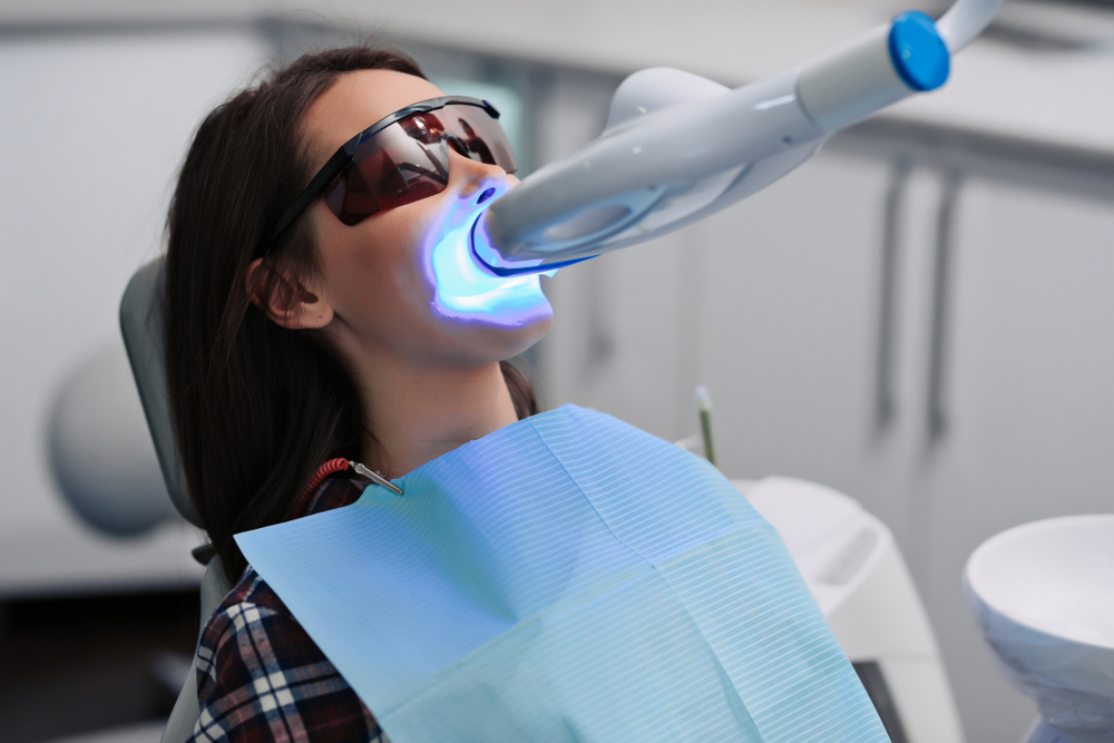 Bleaching / Teeth Whitening