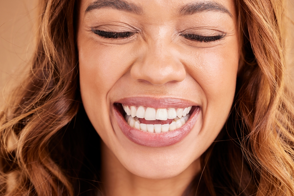 Smile Makeover